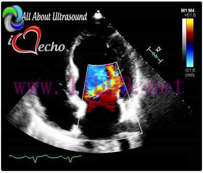 [AME]Adult Echocardiography - Test & Learn Registry Review Quiz - AllAboutUltrasound (Complete ...