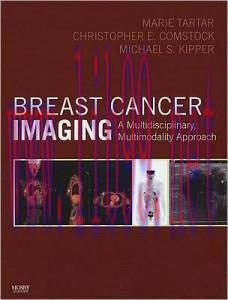 [AME]Breast Cancer Imaging: A Multidisciplinary, Multimodality Approach, 1e (Original PDF)