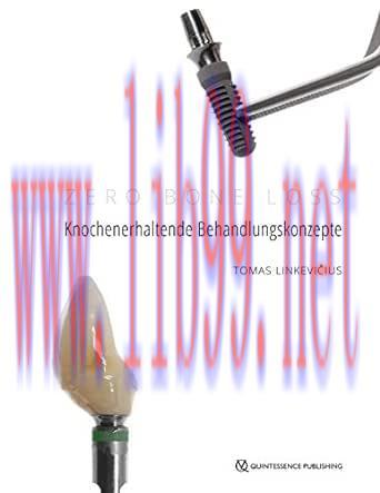 [AME]Zero Bone Loss: Knochenerhaltende Behandlungskonzepte (German Edition) (EPUB)