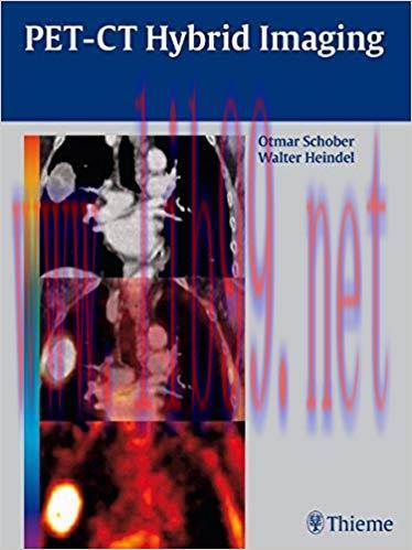 [PDF]PET-CT Hybrid Imaging