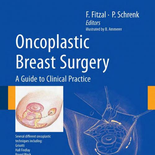 Oncoplastic Breast Surgery-A Guide to Clinical Practice