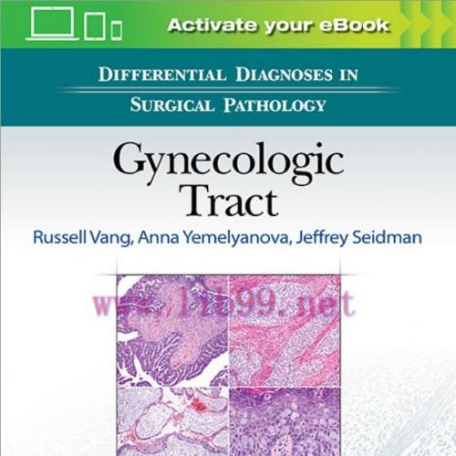 [PDF]Differential Diagnoses in Surgical Pathology: Gynecologic Tract - Original Pdf