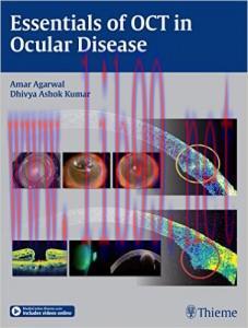 [AME]Essentials of OCT in Ocular Disease