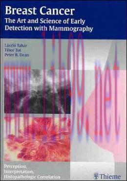 [AME]Breast Cancer - The Art and Science of Early Detection with Mammography: Perception, Inter...