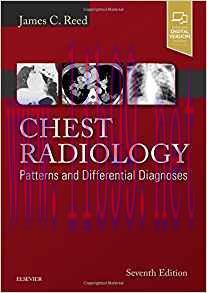 [PDF]Chest Radiology: Patterns and Differential Diagnoses 7th Edition