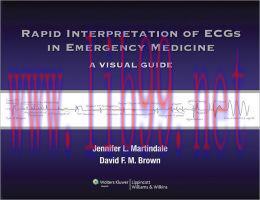 [AME]Rapid Interpretation of ECGs in Emergency Medicine: A Visual Guide (ORIGINAL PDF from_ Pub...