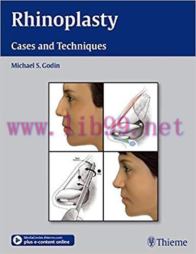[PDF]Rhinoplasty - Cases and Techniques + Videos