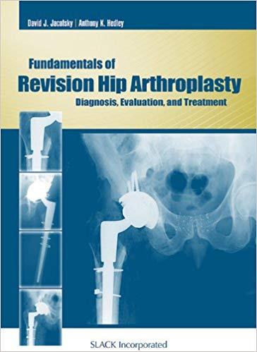 Fundamentals of Revision Hip Arthroplasty - Diagnosis, Evaluation, and Treatment