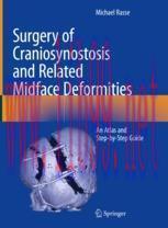 [PDF]Surgery of Craniosynostosis and Related Midface Deformities: An Atlas and Step-by-Step Gui...