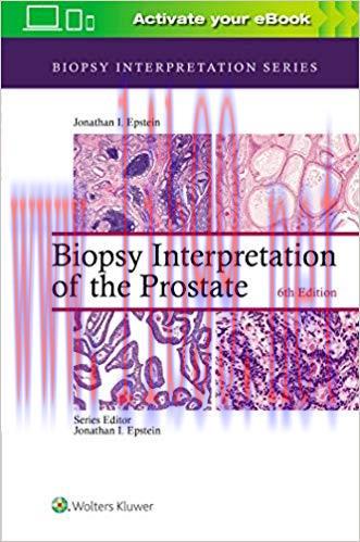 [Html]Biopsy Interpretation of the Prostate 6th Edition