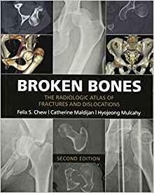 Broken Bones - The Radiologic Atlas of Fractures and Dislocations 2nd Edition