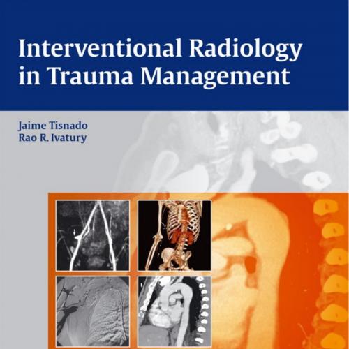 Interventional Radiology in Trauma Management