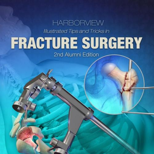 Harborview Illustrated Tips and Tricks in Fracture Surgery