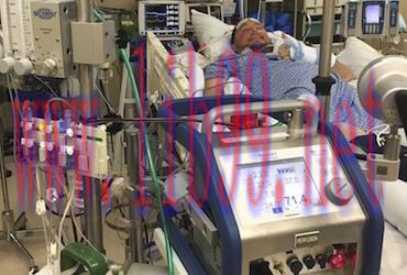 [AME]Adult ECLS Course &ndash; Innovative ECMO Concepts (Complete Contents)