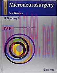 [PDF]Microneurosurgery, Volume IVB Microneurosurgery of CNS Tumors (Yasargil)