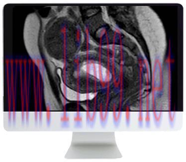 [AME]ARRS Abdominal MRI: Practical Applications and Advanced Imaging Techniques 2021 (CME VIDEO...