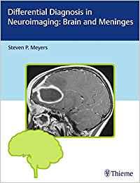 Differential Diagnosis in Neuroimaging - Brain and Meninges