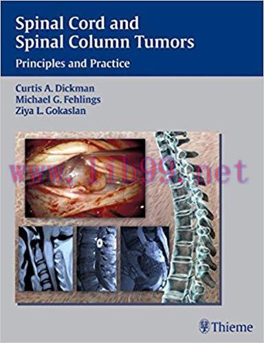 [PDF]Spinal Cord and Spinal Column Tumors