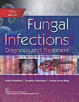 [AME]Fungal Infections Diagnosis and Treatment, 2nd edition (Original PDF)