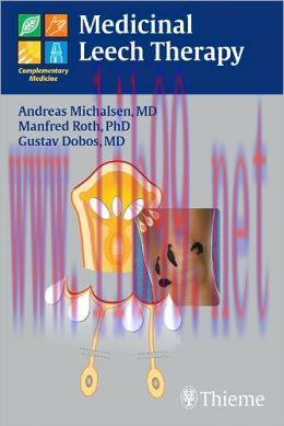 [AME]Medicinal Leech Therapy