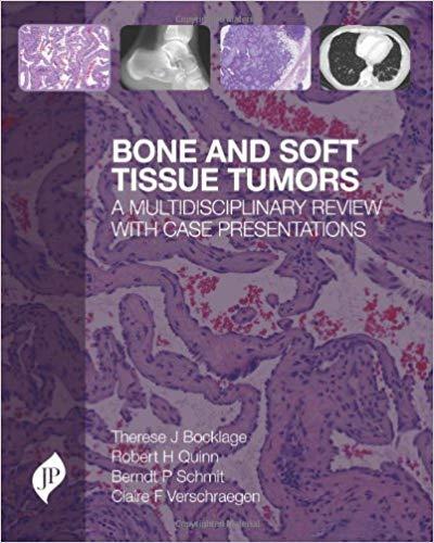 Bone and Soft Tissue Tumors