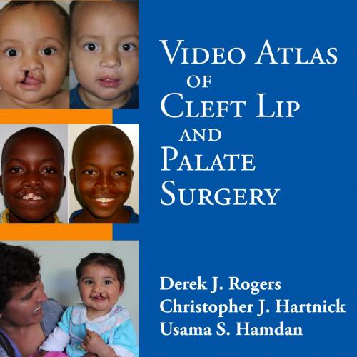Video Atlas of Cleft Lip and Palate Surgery