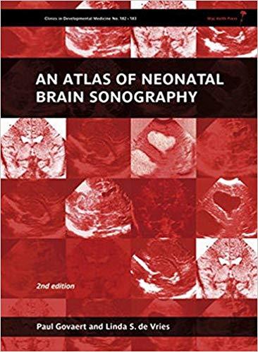 An Atlas of Neonatal Brain Sonography, 2nd Edition