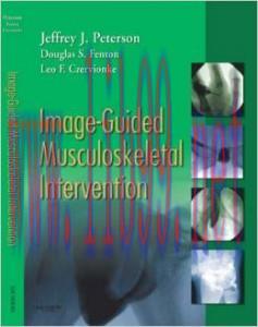 [AME]Image-Guided Musculoskeletal Intervention (True PDF)
