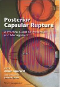 [AME]Posterior Capsular Rupture: A Practical Guide to Prevention and Management (ORIGINAL PDF f...