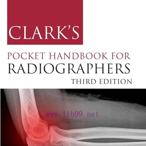 [AME]CONTINUUM Lifelong Learning In Neurology (Spinal Cord Disorders) February 2024, Volume 30,...