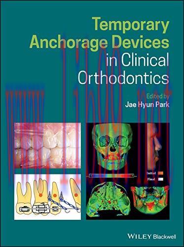 [PDF]Temporary Anchorage Devices in Clinical Orthodontics