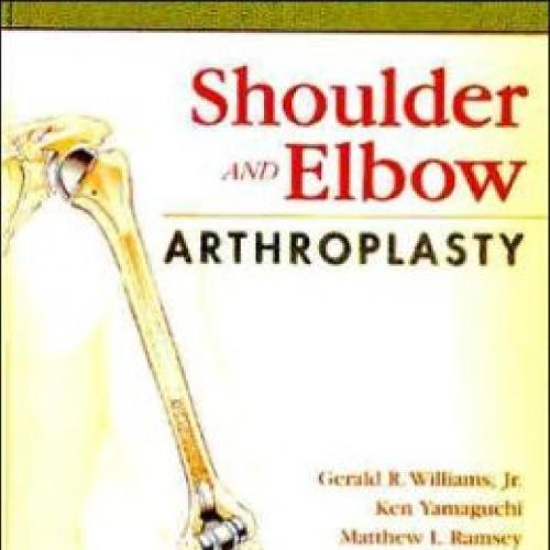 Shoulder and Elbow Arthroplasty - cherylw