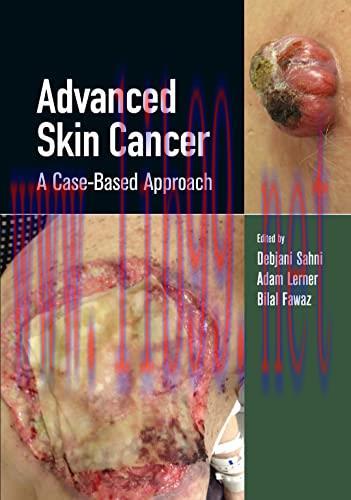 [AME]Advanced Skin Cancer: A Case-Based Approach (Original PDF)