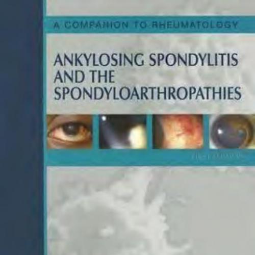 Ankylosing.Spondylitis.and.the.Spondyloarthropathies - Wei Zhi