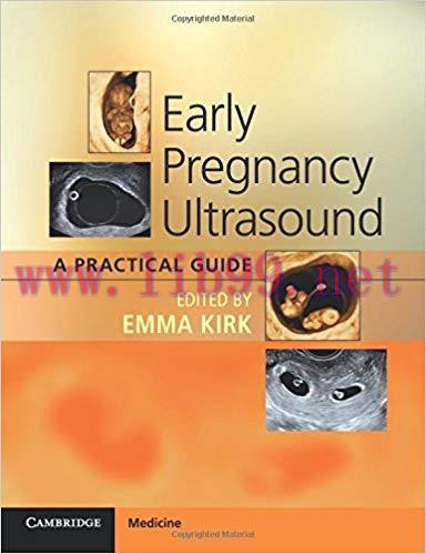 [PDF]Early Pregnancy Ultrasound - A Practical Guide