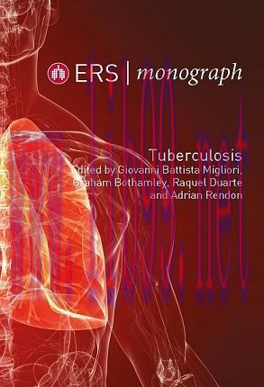 [AME]ERS Monograph 82 (TUberculosis) (PDF)