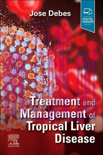 [AME]Treatment and Management of Tropical Liver Disease (ePub+Converted PDF)