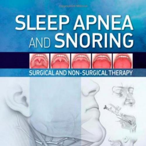 Sleep Apnea and Snoring_ Surgical and Non-Surgical Therapy