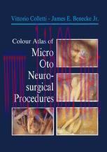 [PDF]Colour Atlas of Micro-Oto-Neurosurgical Procedures