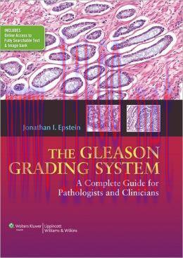 [AME]The Gleason Grading System: A Complete Guide for Pathologist and Clinicians