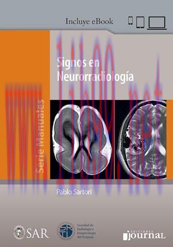 [AME]SIGNOS EN NEURORRADIOLOGIA (High Quality Image PDF)
