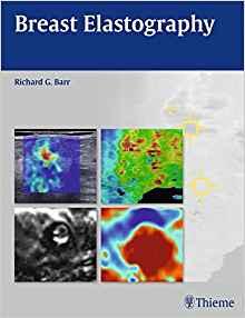 Breast Elastography [Richard G. Barr]