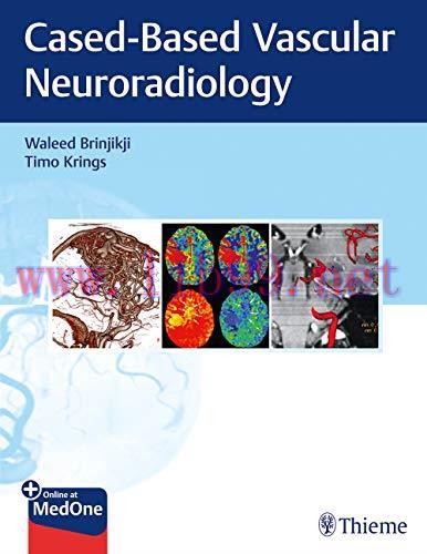 [AME]Imaging in Neurovascular Disease: A Case-Based Approach (Original PDF)