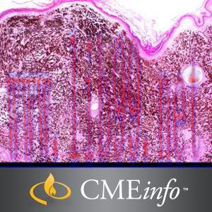 [AME]Dermatopathology: A Comprehensive Review 2014 (CME Videos)