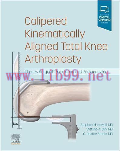 [AME]Calipered Kinematically aligned Total Knee Arthroplasty: Theory, Surgical Techniques and P...
