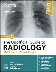 [AME]The Unofficial Guide to Radiology: 100 Practice Chest X-rays, 2nd Edition (True PDF from_ ...