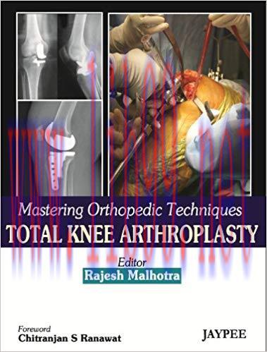[PDF]Mastering Orthopedic Techniques Total Knee Arthroplasty