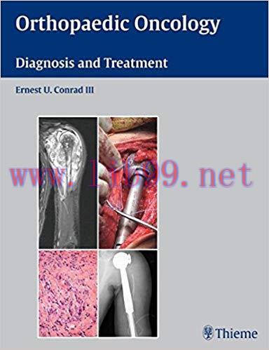 [PDF]Orthopaedic Oncology - Diagnosis and Treatment