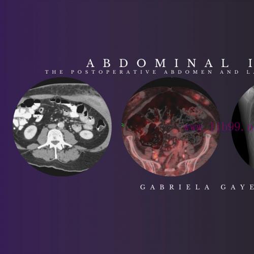 [AME]Abdominal Imaging – Gabriela Gayer, M.D. (CMEScience) (CME Videos)