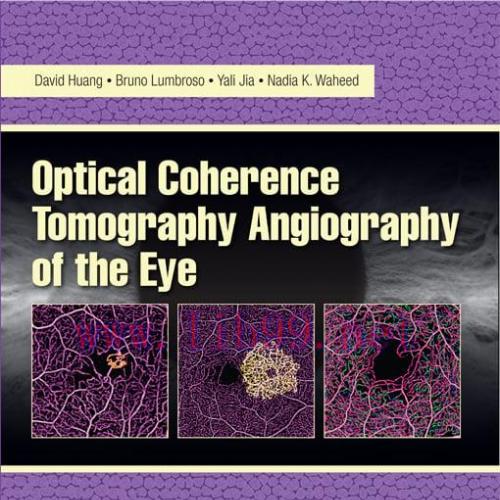 [AME]Optical Coherence Tomography Angiography of the Eye (Original PDF)